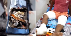 FOTO/VIDEO: Bărbat, rănit după ce i-a explodat smartphone-ul în buzunar. Modelul, vândut și în Moldova